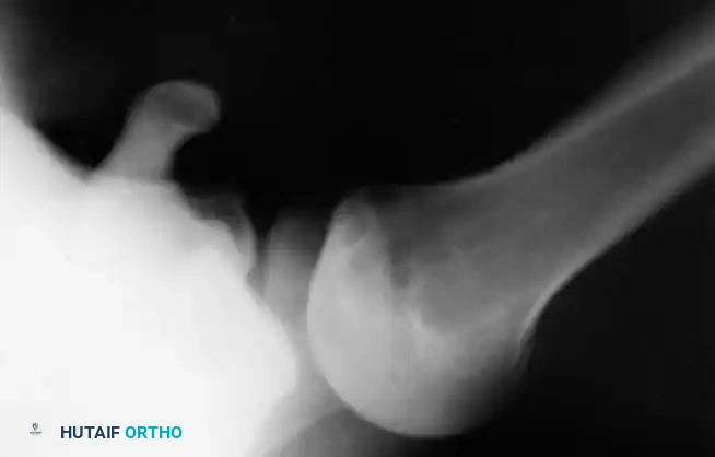 Hutaifortho's Orthopaedic Diagram