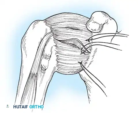 Hutaifortho's Orthopaedic Diagram
