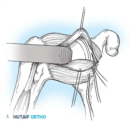 Hutaifortho's Orthopaedic Diagram