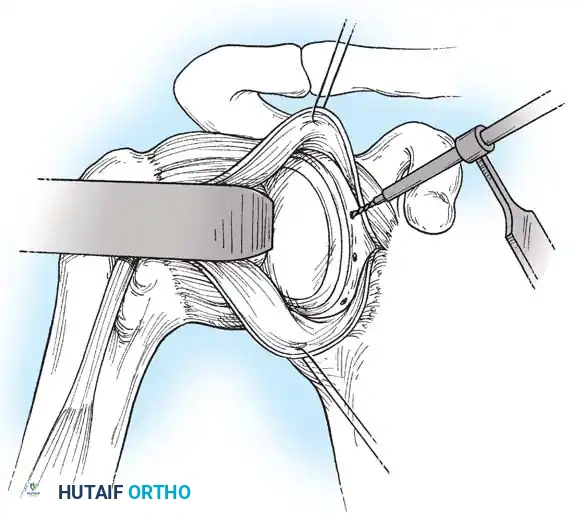 Hutaifortho's Orthopaedic Diagram
