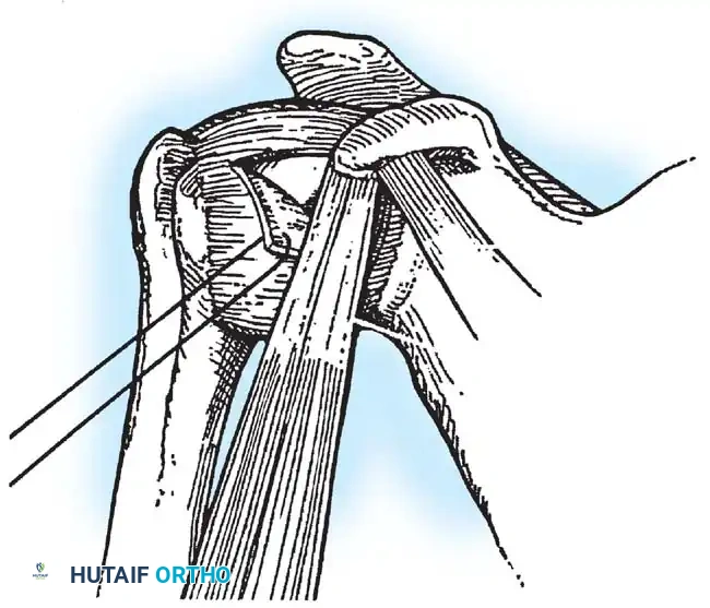 Hutaifortho's Orthopaedic Diagram