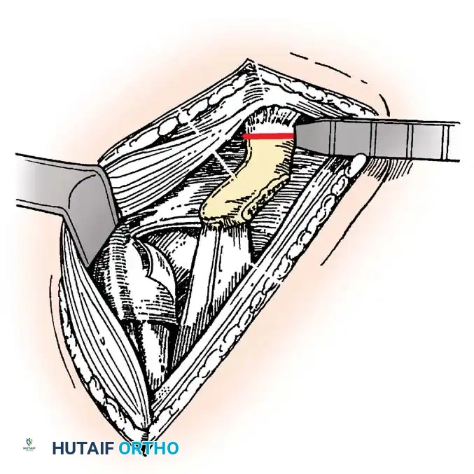 Hutaifortho's Orthopaedic Diagram