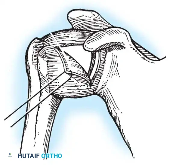 Hutaifortho's Orthopaedic Diagram