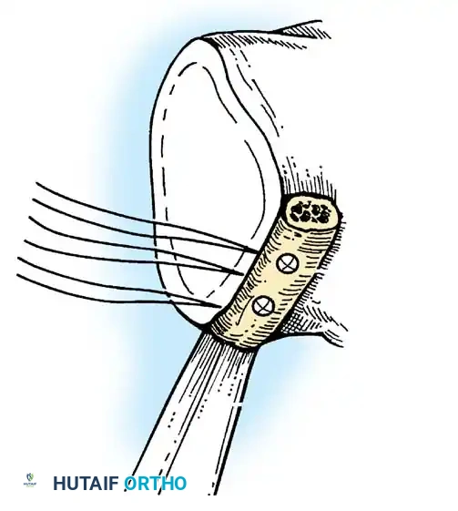 Hutaifortho's Orthopaedic Diagram