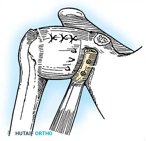 Hutaifortho's Orthopaedic Diagram