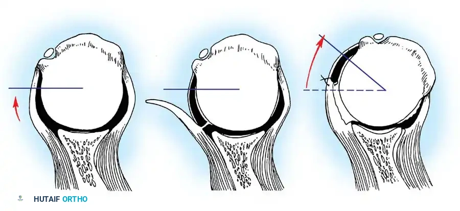 Hutaifortho's Orthopaedic Diagram