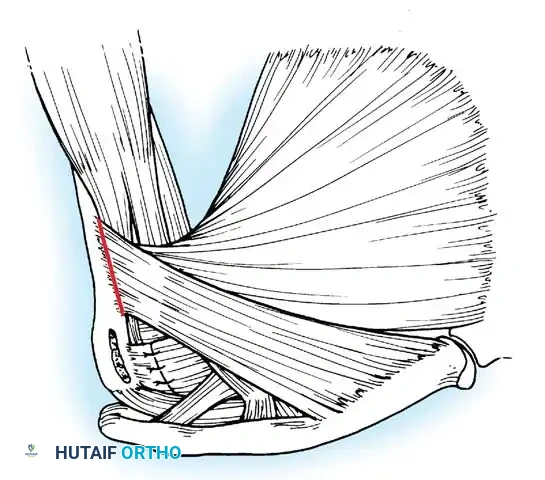 Hutaifortho's Orthopaedic Diagram