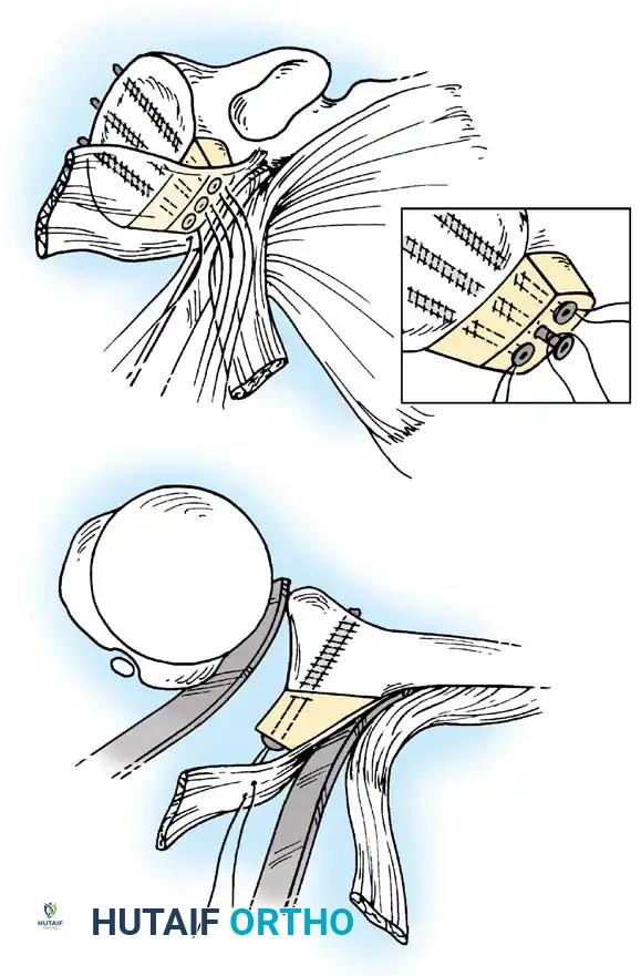 Hutaifortho's Orthopaedic Diagram