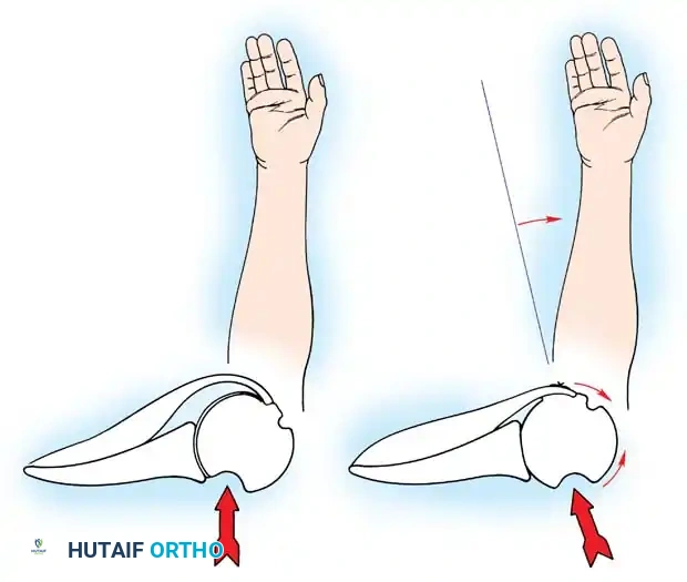 Hutaifortho's Orthopaedic Diagram