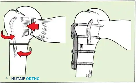 Hutaifortho's Orthopaedic Diagram