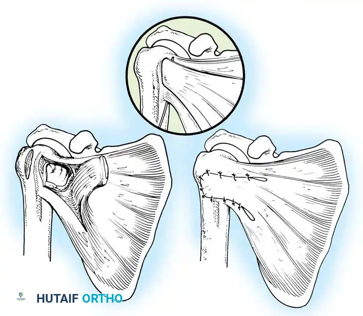 Hutaifortho's Orthopaedic Diagram