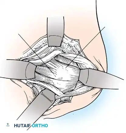 Hutaifortho's Orthopaedic Diagram