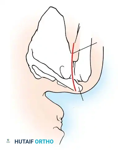Hutaifortho's Orthopaedic Diagram