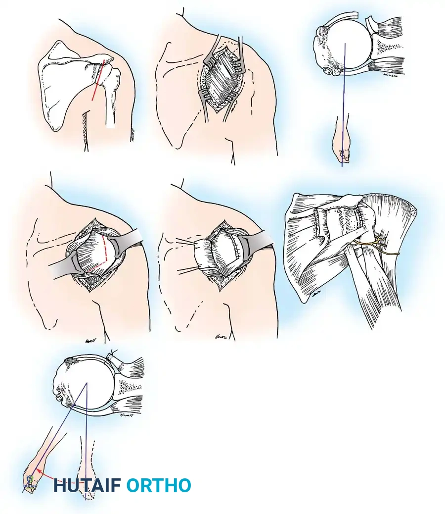 Hutaifortho's Orthopaedic Diagram