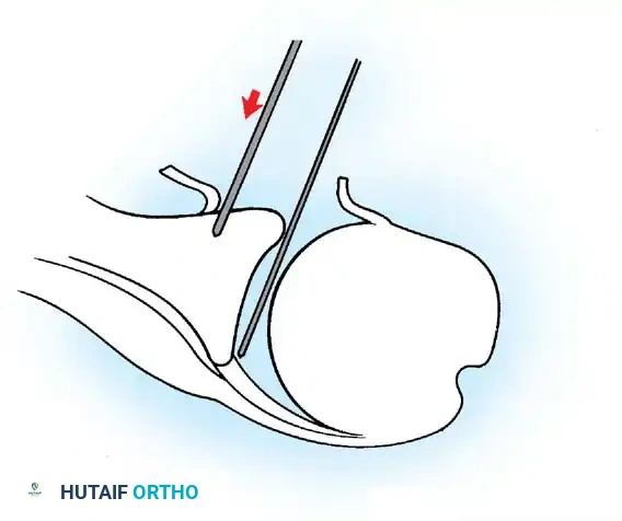 Hutaifortho's Orthopaedic Diagram