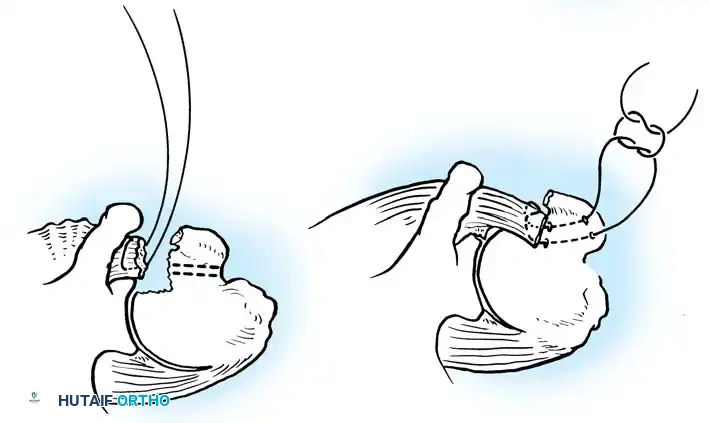 Hutaifortho's Orthopaedic Diagram