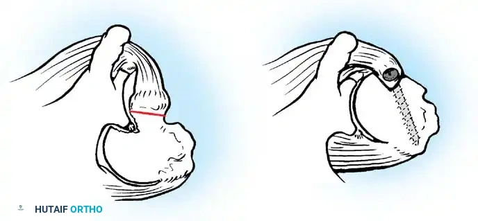Hutaifortho's Orthopaedic Diagram