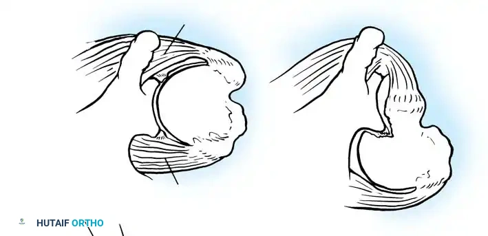 Hutaifortho's Orthopaedic Diagram