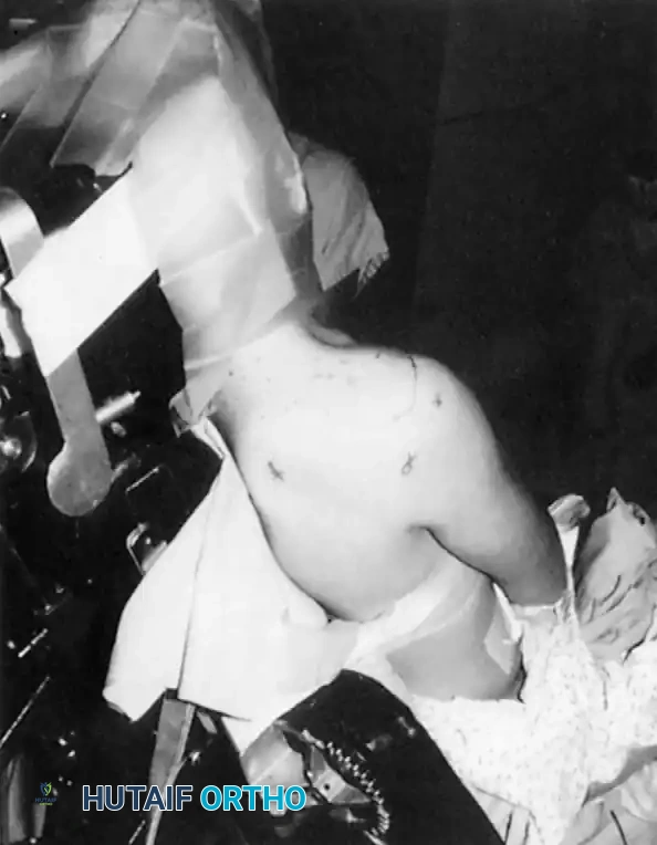 Fig. 49-3 Beach-chair position