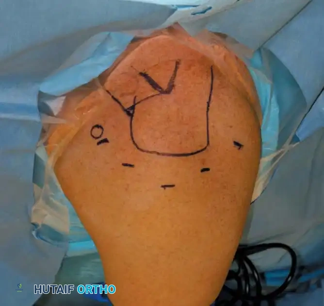 Fig. 49-4 Bone landmarks