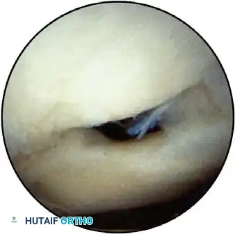 Hutaifortho's Orthopaedic Diagram