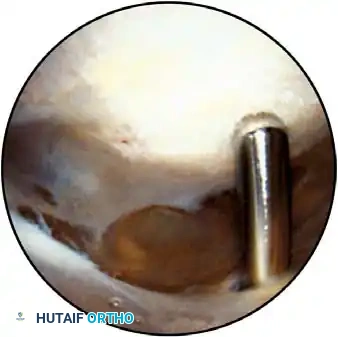 Hutaifortho's Orthopaedic Diagram