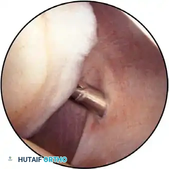 Hutaifortho's Orthopaedic Diagram