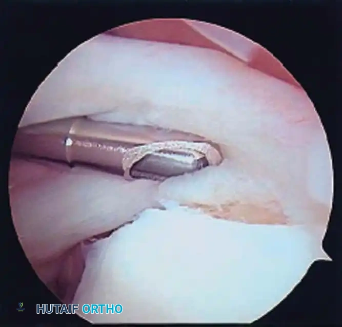 Hutaifortho's Orthopaedic Diagram