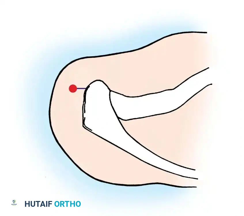 Hutaifortho's Orthopaedic Diagram