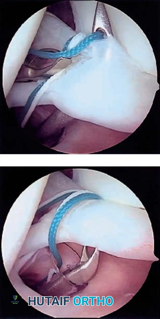 Hutaifortho's Orthopaedic Diagram