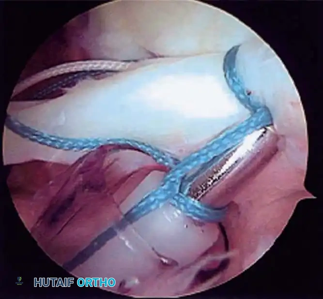 Hutaifortho's Orthopaedic Diagram