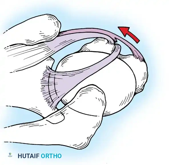Hutaifortho's Orthopaedic Diagram
