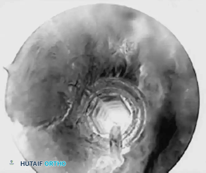 Hutaifortho's Orthopaedic Diagram