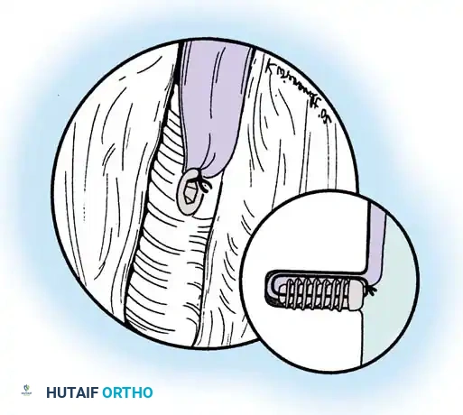 Hutaifortho's Orthopaedic Diagram