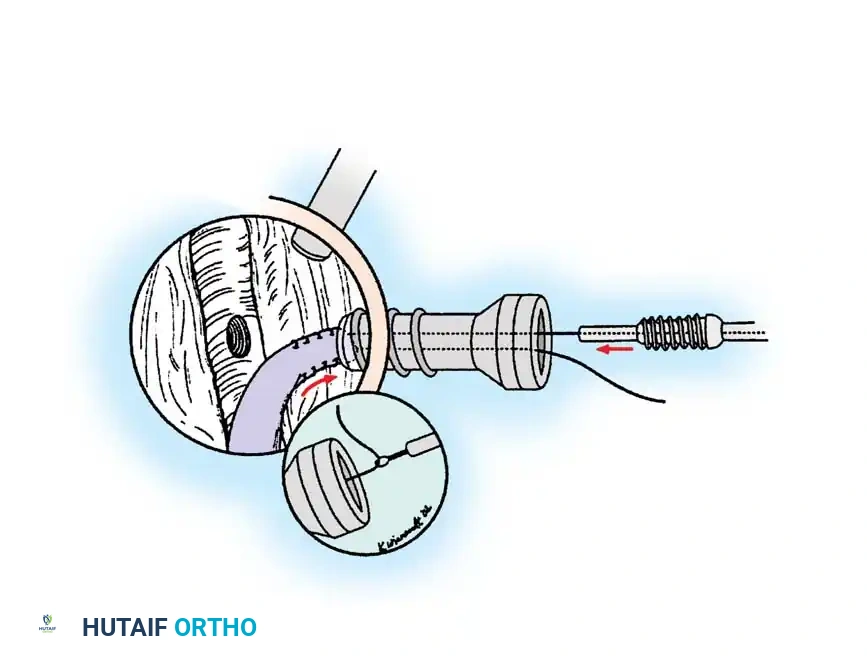 Hutaifortho's Orthopaedic Diagram