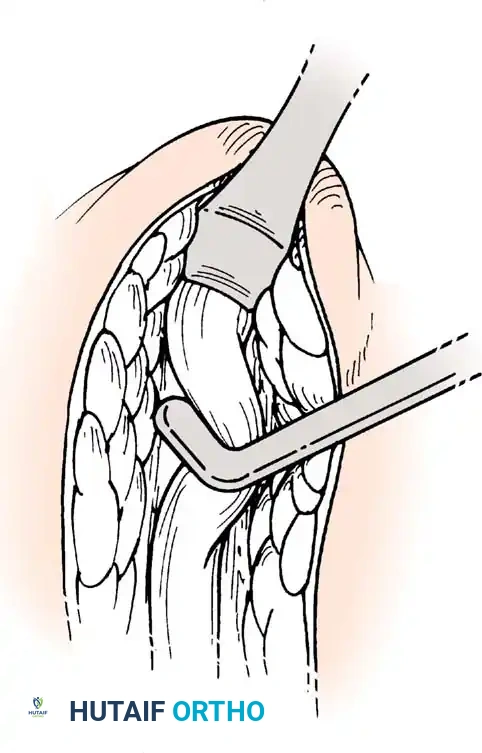 Hutaifortho's Orthopaedic Diagram