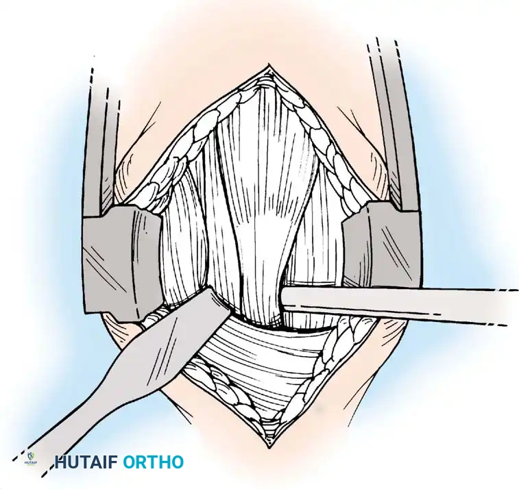 Hutaifortho's Orthopaedic Diagram