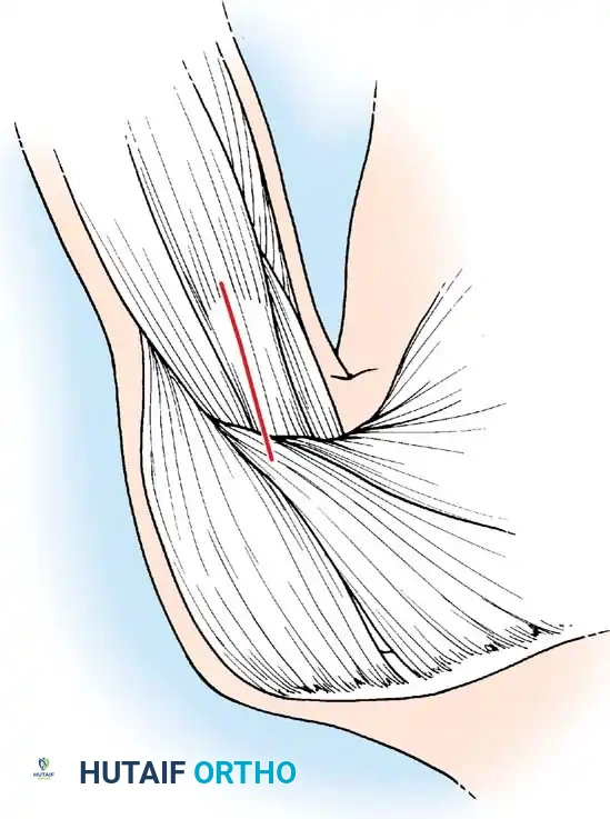 Hutaifortho's Orthopaedic Diagram