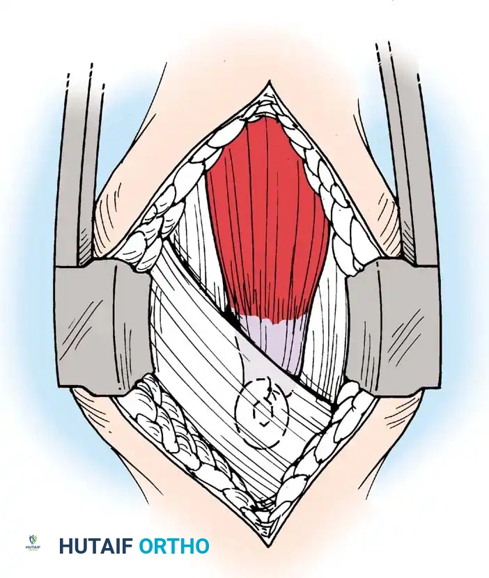 Hutaifortho's Orthopaedic Diagram
