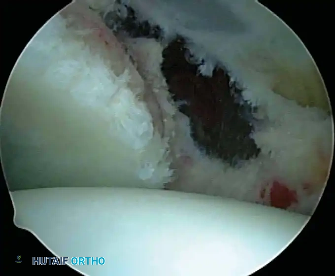 Hutaifortho's Orthopaedic Diagram