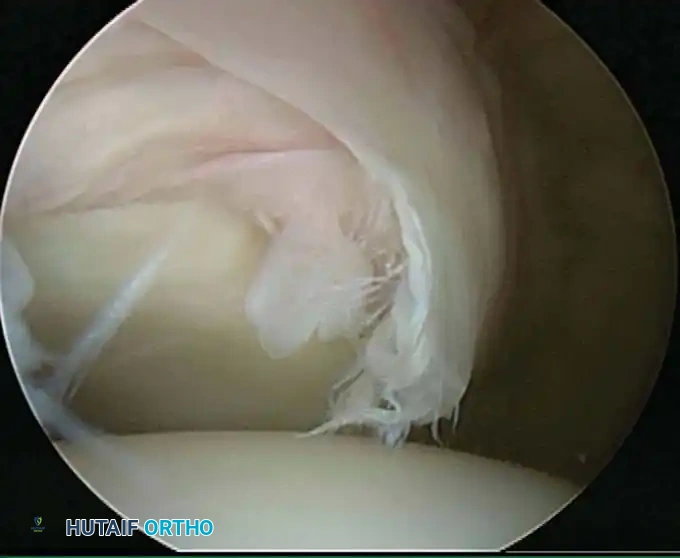 Hutaifortho's Orthopaedic Diagram