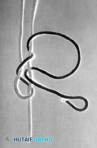 Hutaifortho's Orthopaedic Diagram