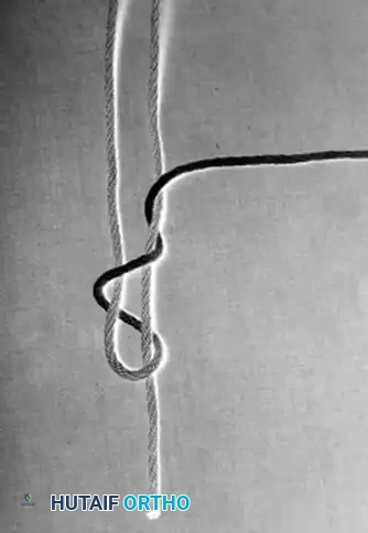 Hutaifortho's Orthopaedic Diagram