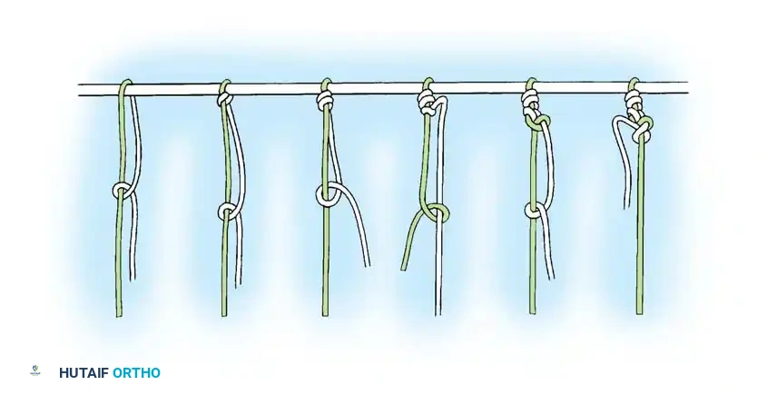 Hutaifortho's Orthopaedic Diagram