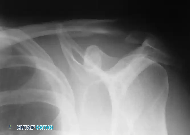 Hutaifortho's Orthopaedic Diagram