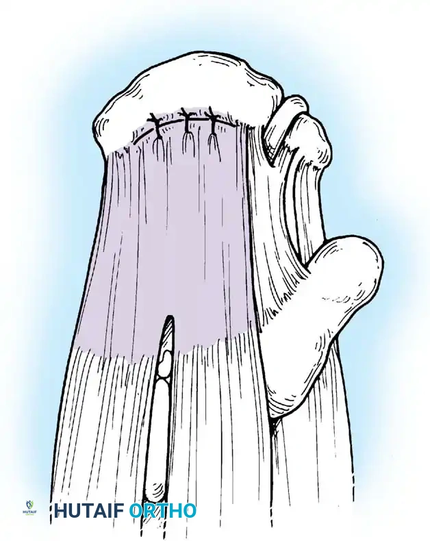 Hutaifortho's Orthopaedic Diagram