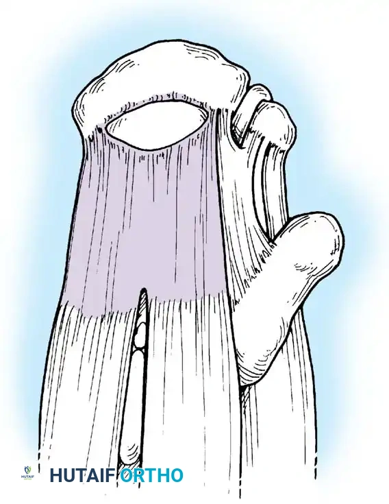 Hutaifortho's Orthopaedic Diagram