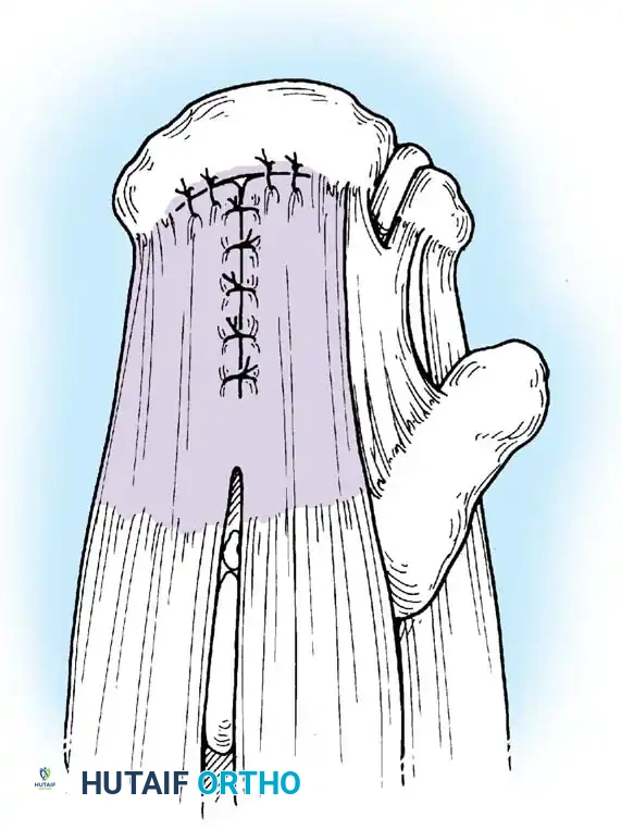 Hutaifortho's Orthopaedic Diagram