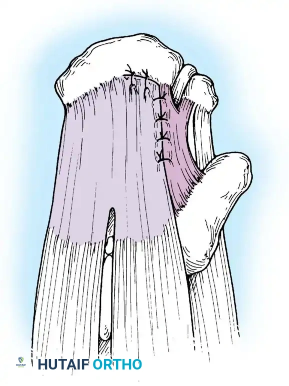 Hutaifortho's Orthopaedic Diagram