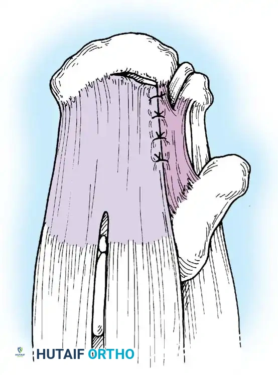 Hutaifortho's Orthopaedic Diagram